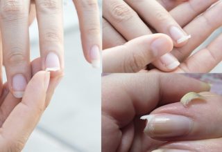 Check your nails right away if you have these symptoms, you may have a very serious illness.