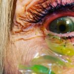 What happens if you don’t remove the lens from your eye?  A woman did this for 23 days, the result is shocking!