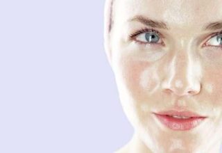 Does Facial Cleansing Gel Cause Acne?