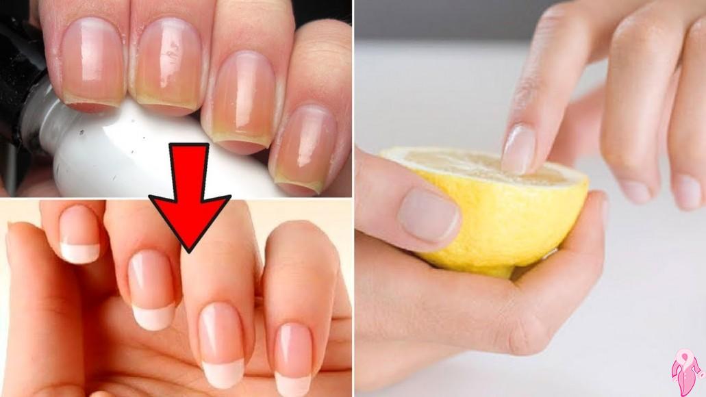 Nail Whitening Methods Lemon and Toothpaste