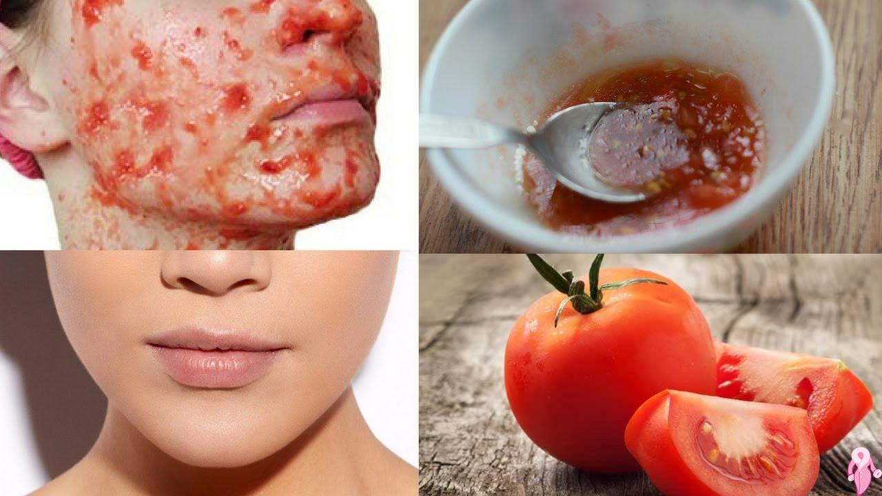 What Are the Benefits of Tomatoes for the Skin