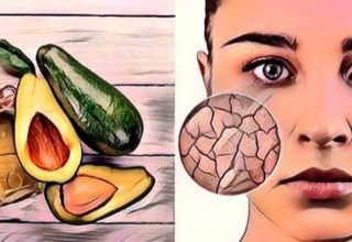 5 Amazing Benefits of Avocado Oil for Skin