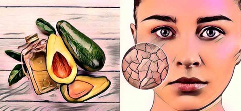 5 Amazing Benefits of Avocado Oil for Skin