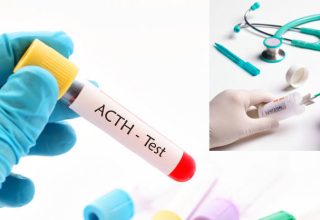 What is ACTH and what should its normal values ​​be?