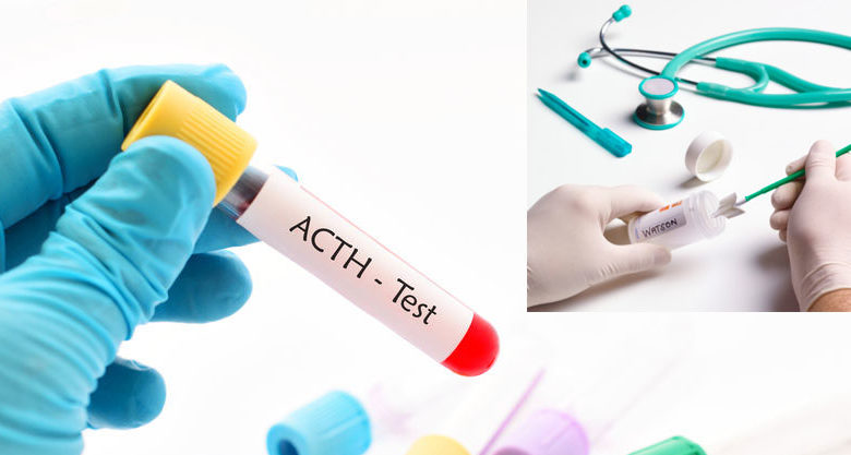 What is ACTH and what should its normal values ​​be