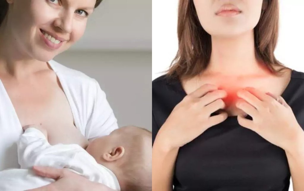 16 Reasons Why Your Breasts Are Itching According to Doctors