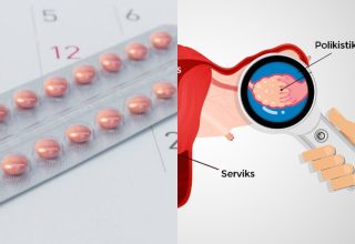 Birth control pill may reduce risk of type 2 diabetes in women with polycystic ovary syndrome