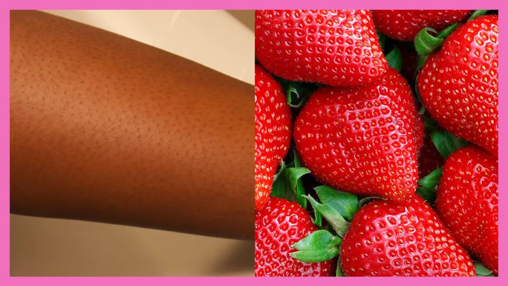 How Does Strawberry Leg Go Natural Recipes Solutions