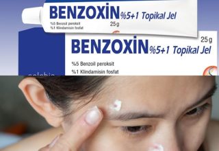 What is Benzoxin Cream, What Does It Do, How Is It Used?